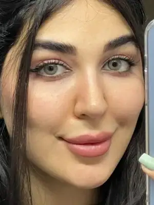 خرید لنز رنگی طوسی عسلی دهب پرل