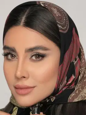 خرید لنز رنگی عسلی آیس کالر دیپ مارس
