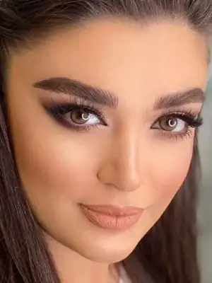 خرید لنز رنگی عسلی آیس کالر رادین گلد