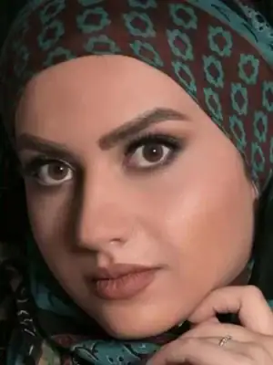 خرید لنز رنگی عسلی آرین براون تن1