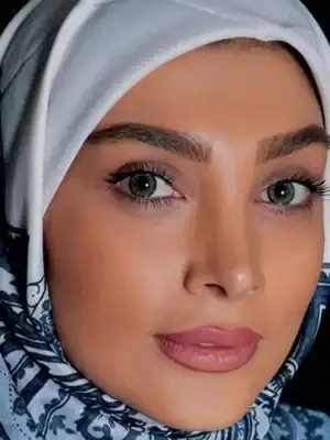 خرید لنز رنگی سبز آرین گرین تن2
