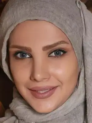 خرید لنز رنگی آبی آرین اسکای بلو تن2