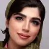 خرید لنز رنگی آبی سولکو تویینز آکوا
