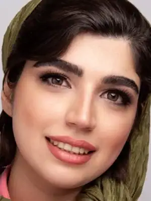 خرید لنز رنگی عسلی سولکو تویینز اسپایس