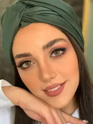 خرید لنز رنگی عسلی اف ایکس ارورا براون