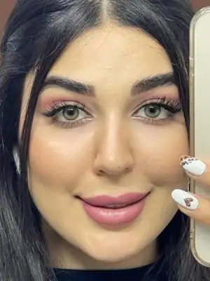 خرید لنز رنگی طوسی عسلی دهب نچرال هانی