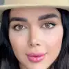 خرید لنز رنگی عسلی یونیک لوندر