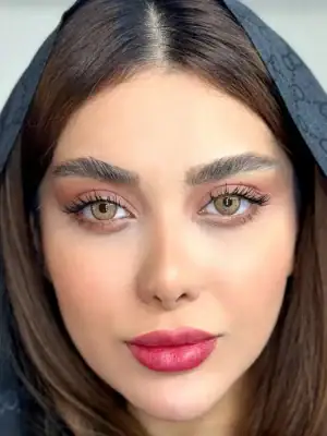خرید لنز رنگی عسلی یونیک فلامینگو