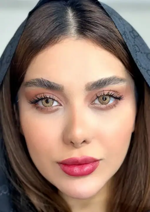 خرید لنز رنگی عسلی یونیک فلامینگو