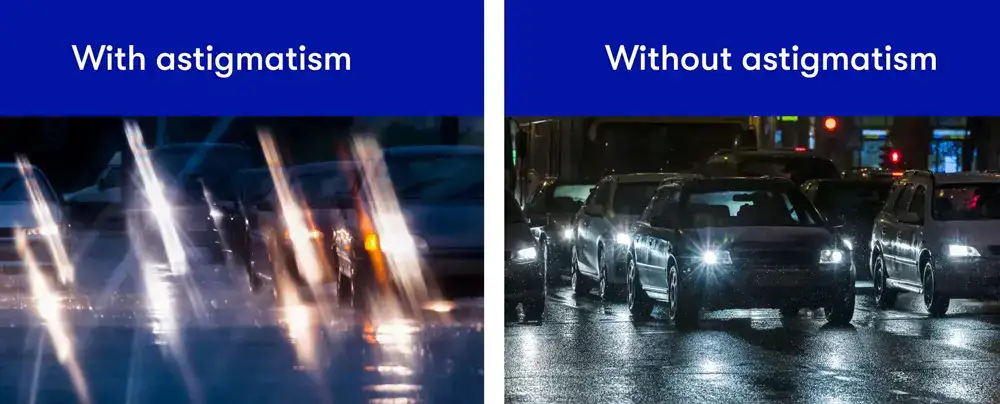 آستیگماتیسم چیست و چه علائمی دارد؟