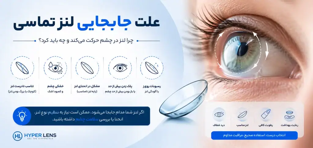 علت حرکت لنز در چشم چیست؟