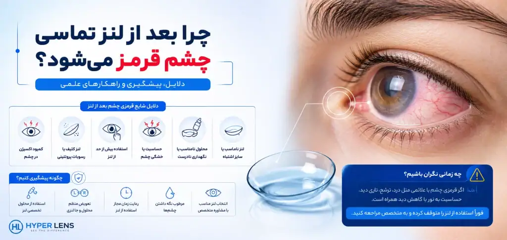 چرا بعد از گذاشتن لنز چشم قرمز میشود؟