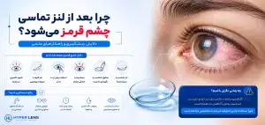 چرا بعد از گذاشتن لنز چشم قرمز میشود؟