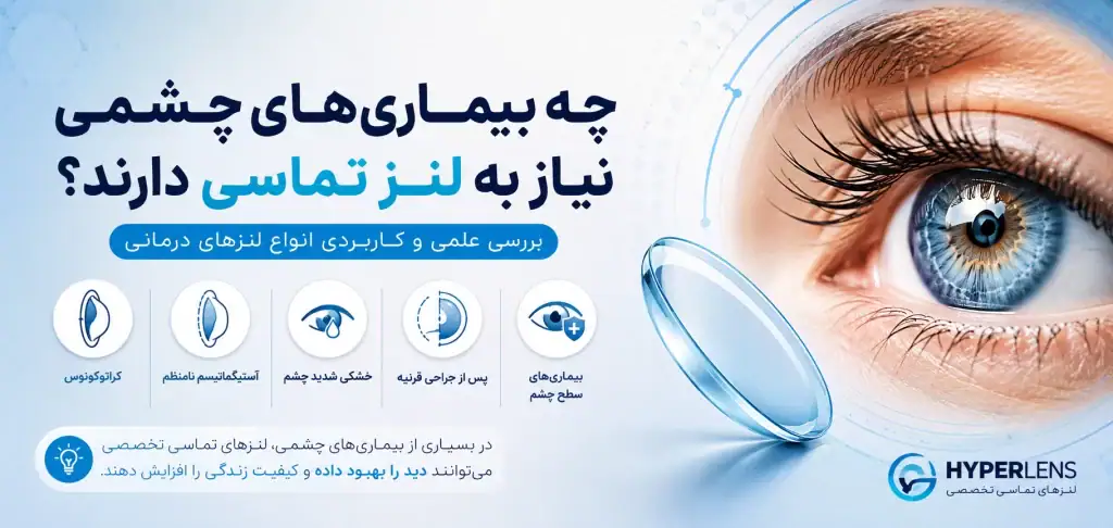 چه بیماری های چشمی نیاز به لنز دارند؟